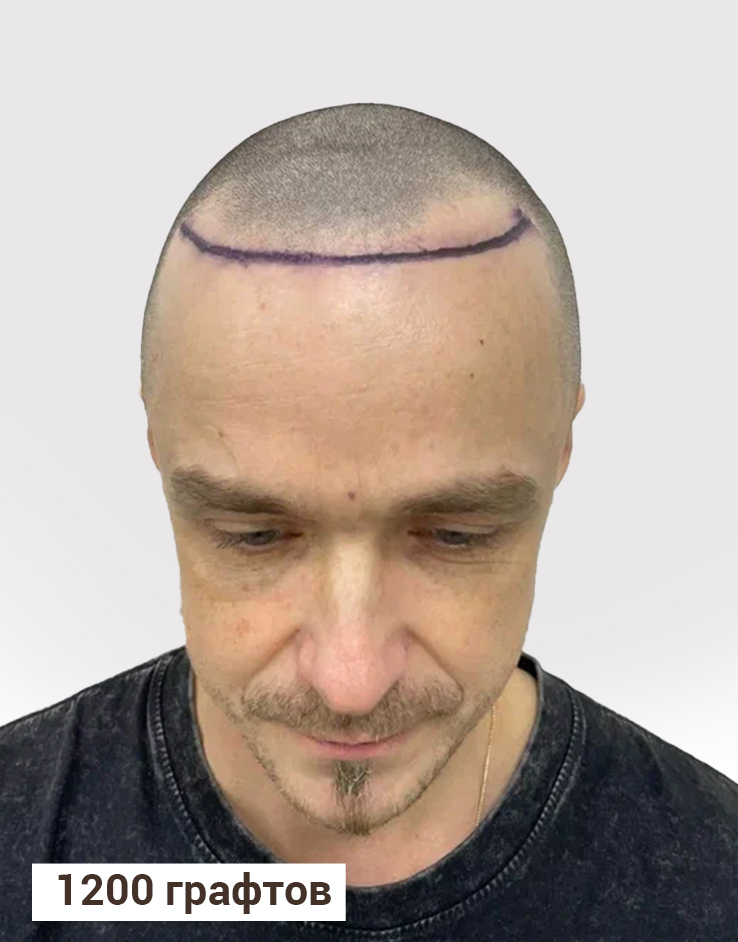 Результат До