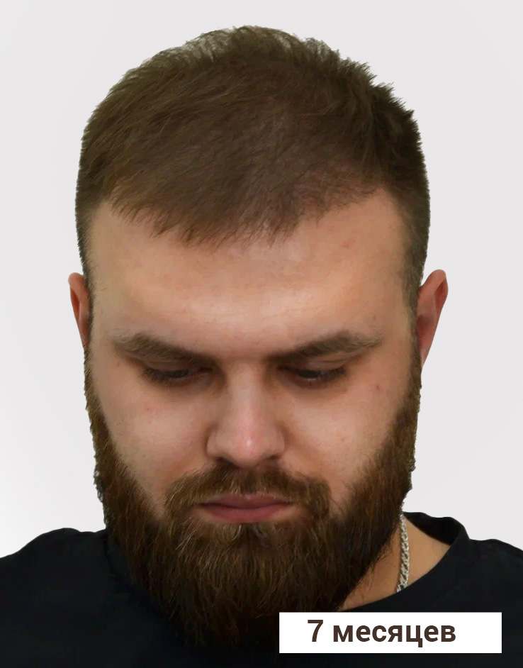 Результат После