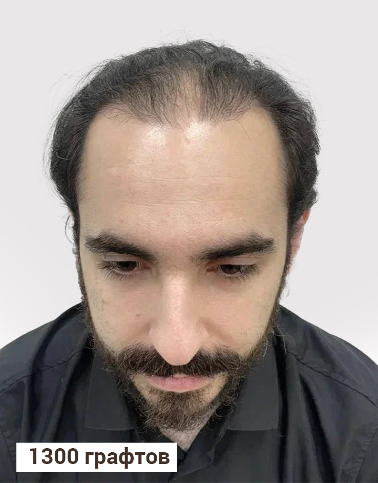 Результат До