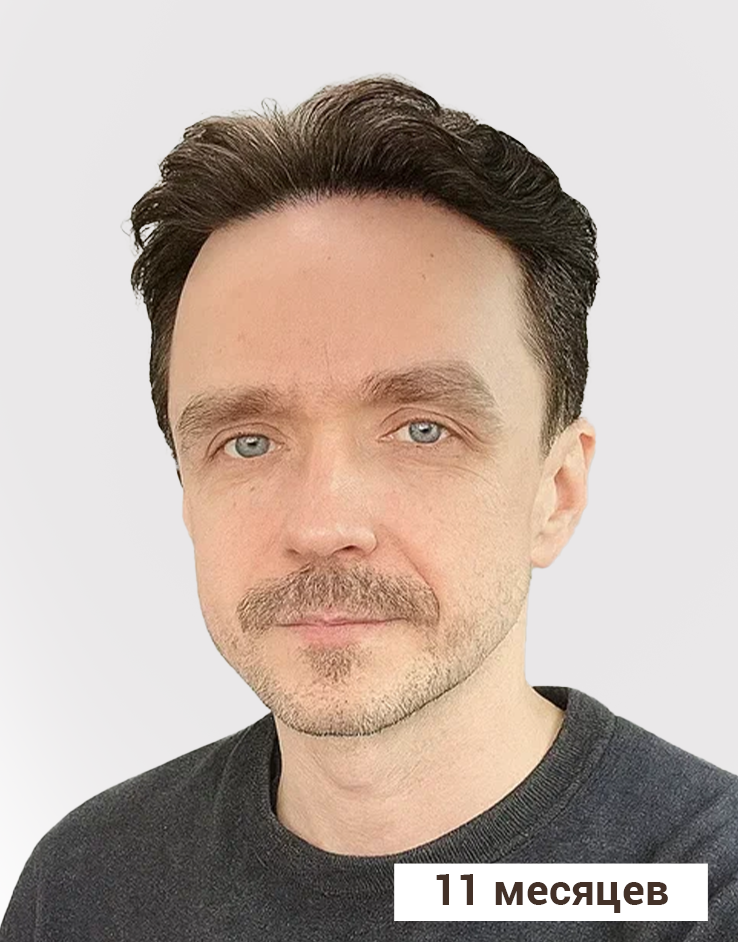 Результат После