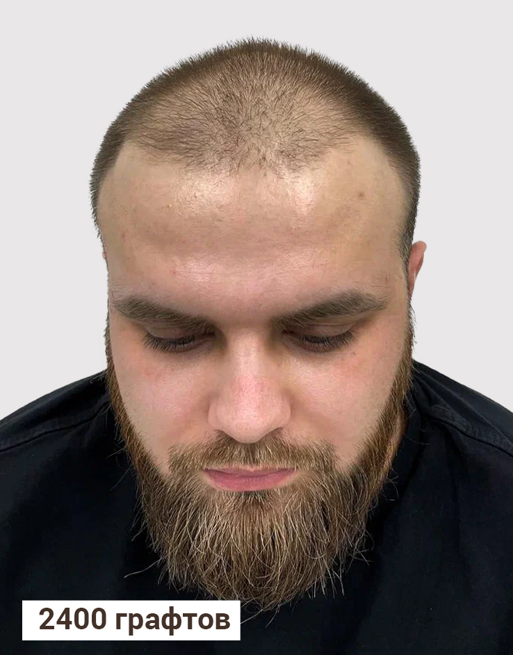 Результат До